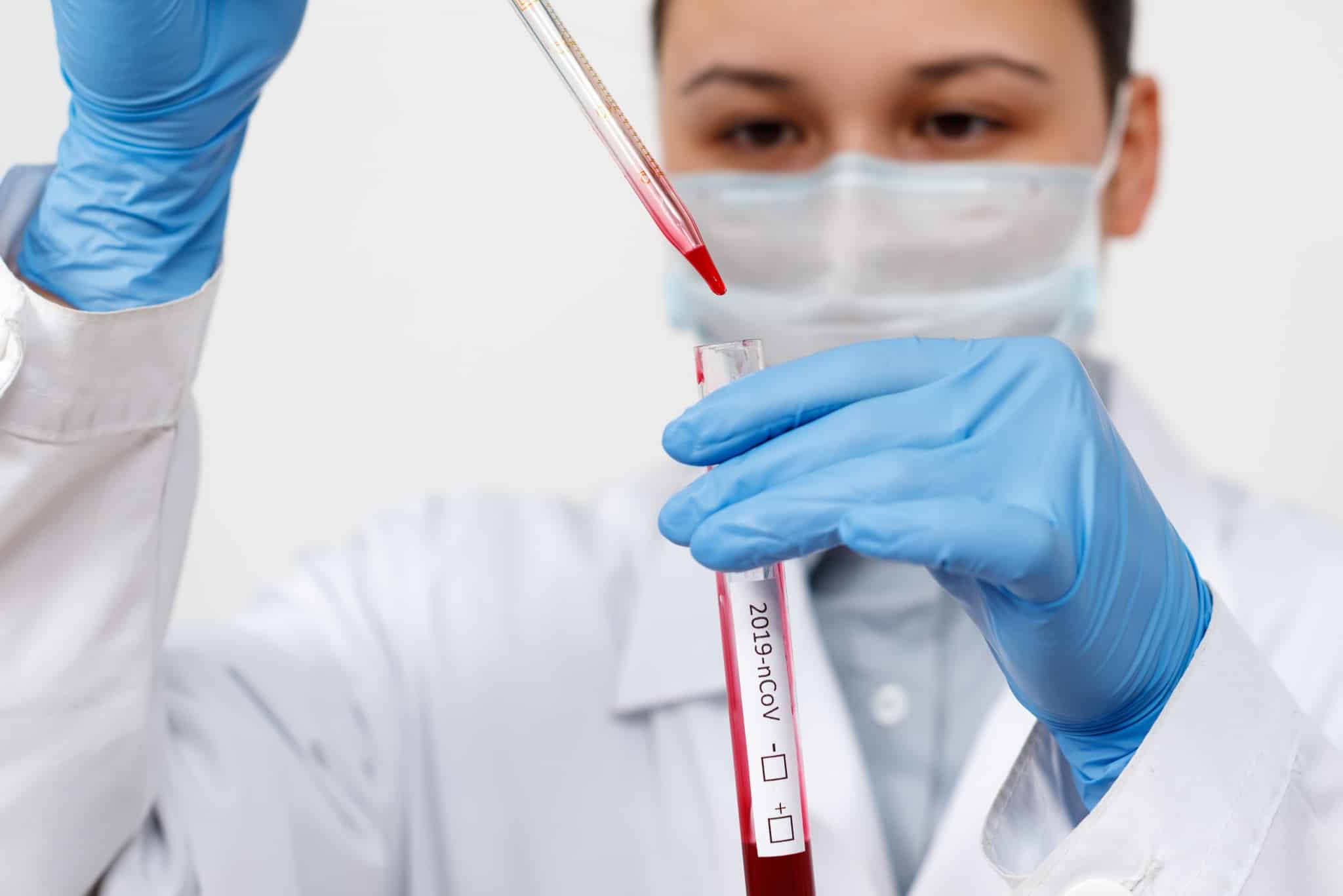 Epidemiólogo realizando análisis de sangre