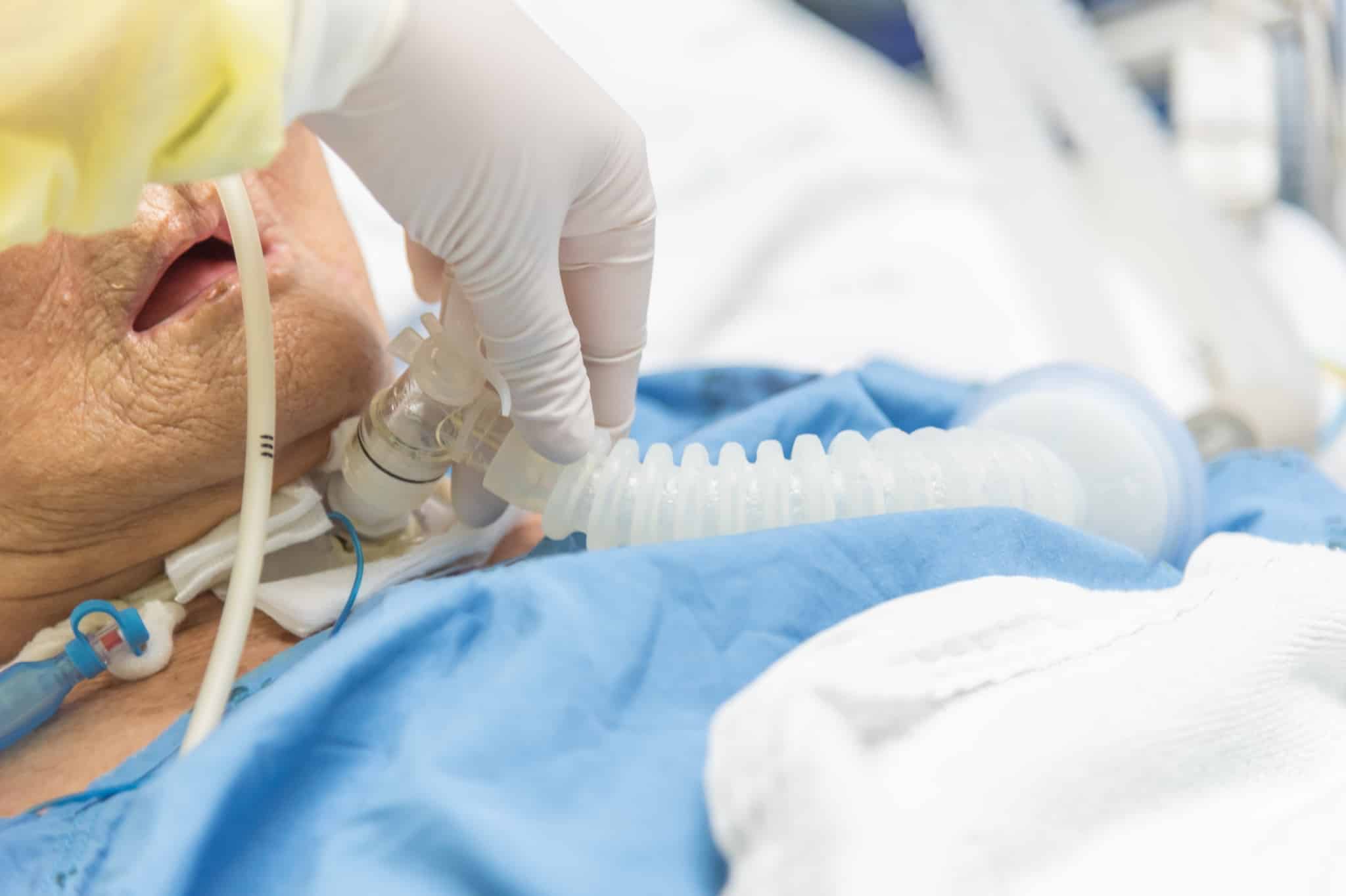 Close up of elderly patient with a tracheostomy