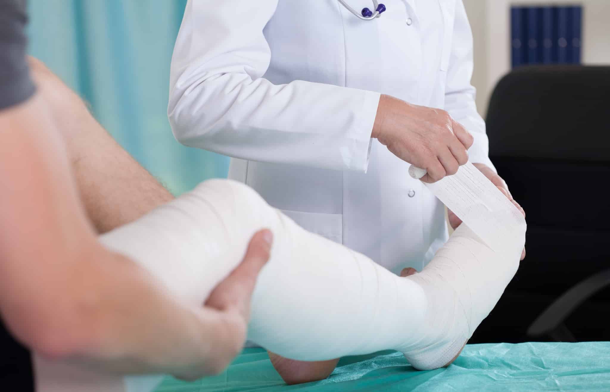 Patient with their leg in a plaster cast