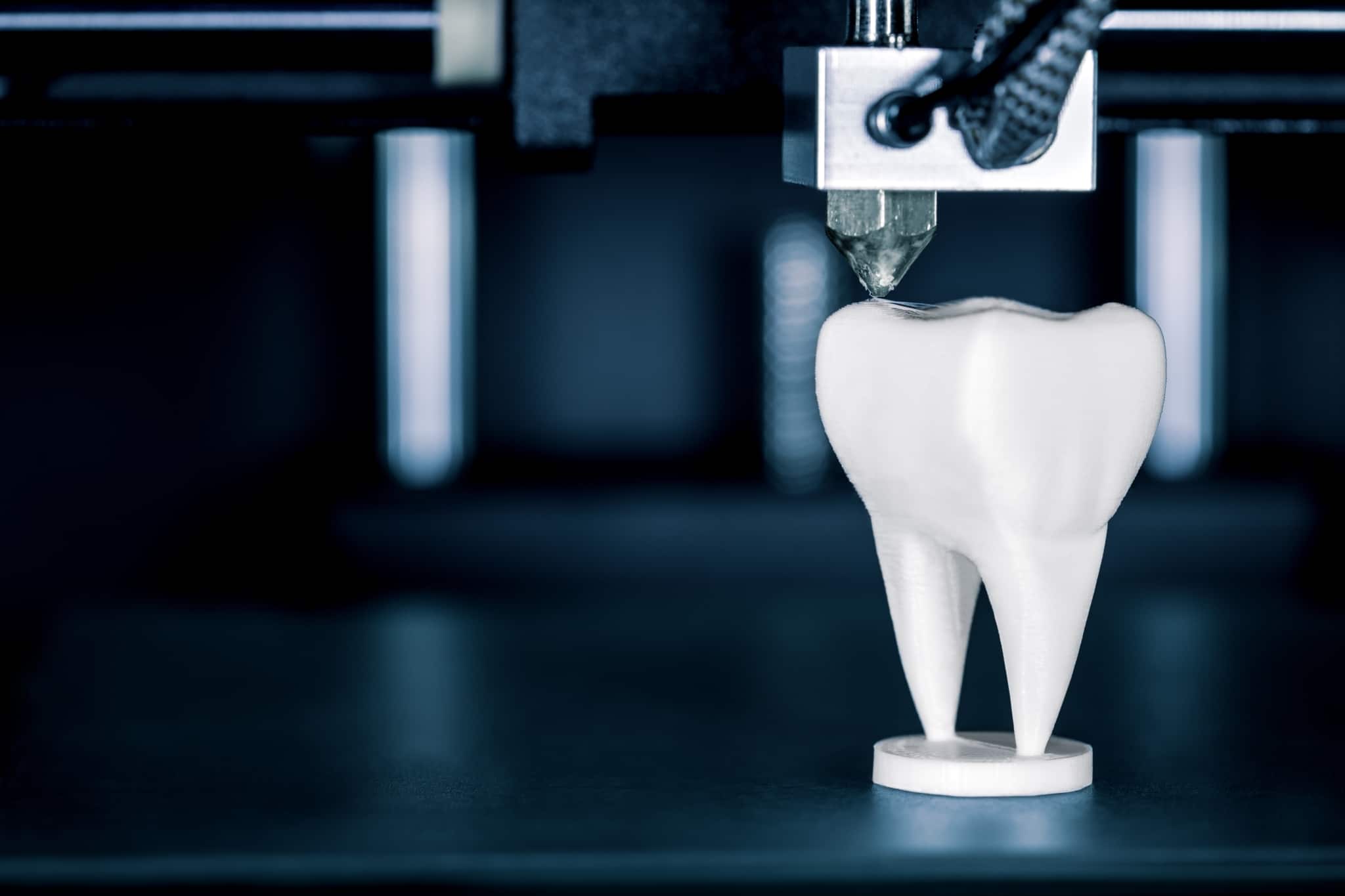Primer plano de una impresora 3D que crea dentaduras postizas