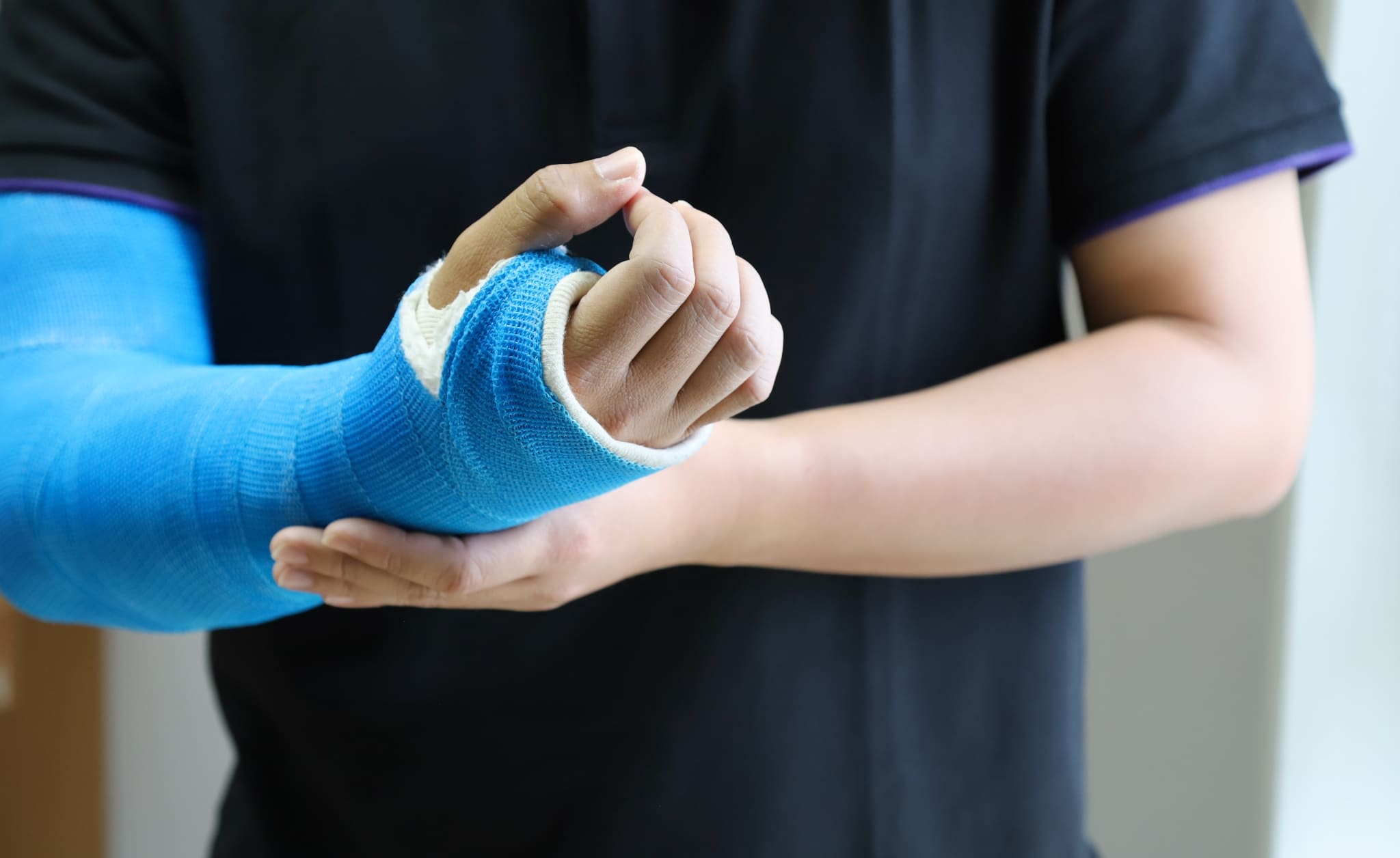 Close up of a man with his arm in a blue cast