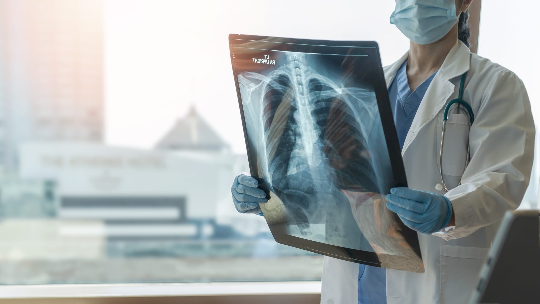 Medical professional looking at an X-ray of the lungs
