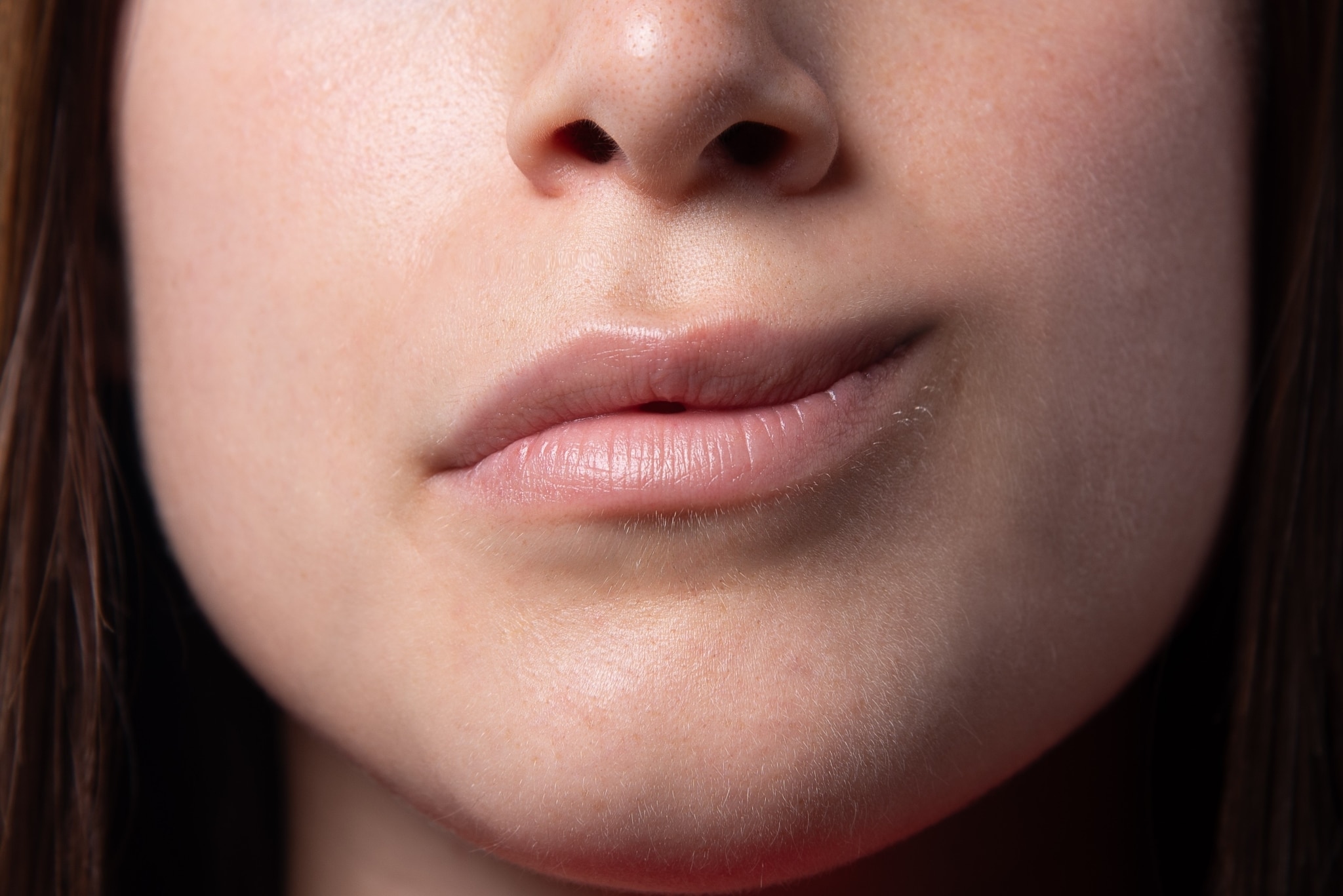 Close up of the mouth of a woman with Bell's palsy